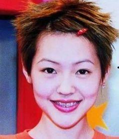 明星是什么牙齿,揭秘明星完美牙齿的秘密