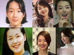 中国整容的明星,揭秘美丽背后的故事