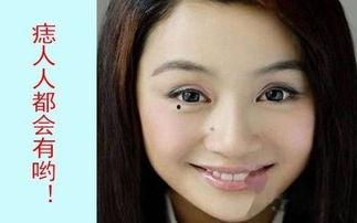脸上长黑点的明星,揭秘脸上黑点明星的美丽秘诀